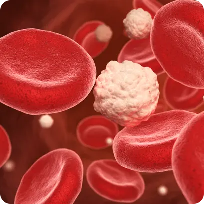 7 cosas que debes saber sobre la Dislipidemia